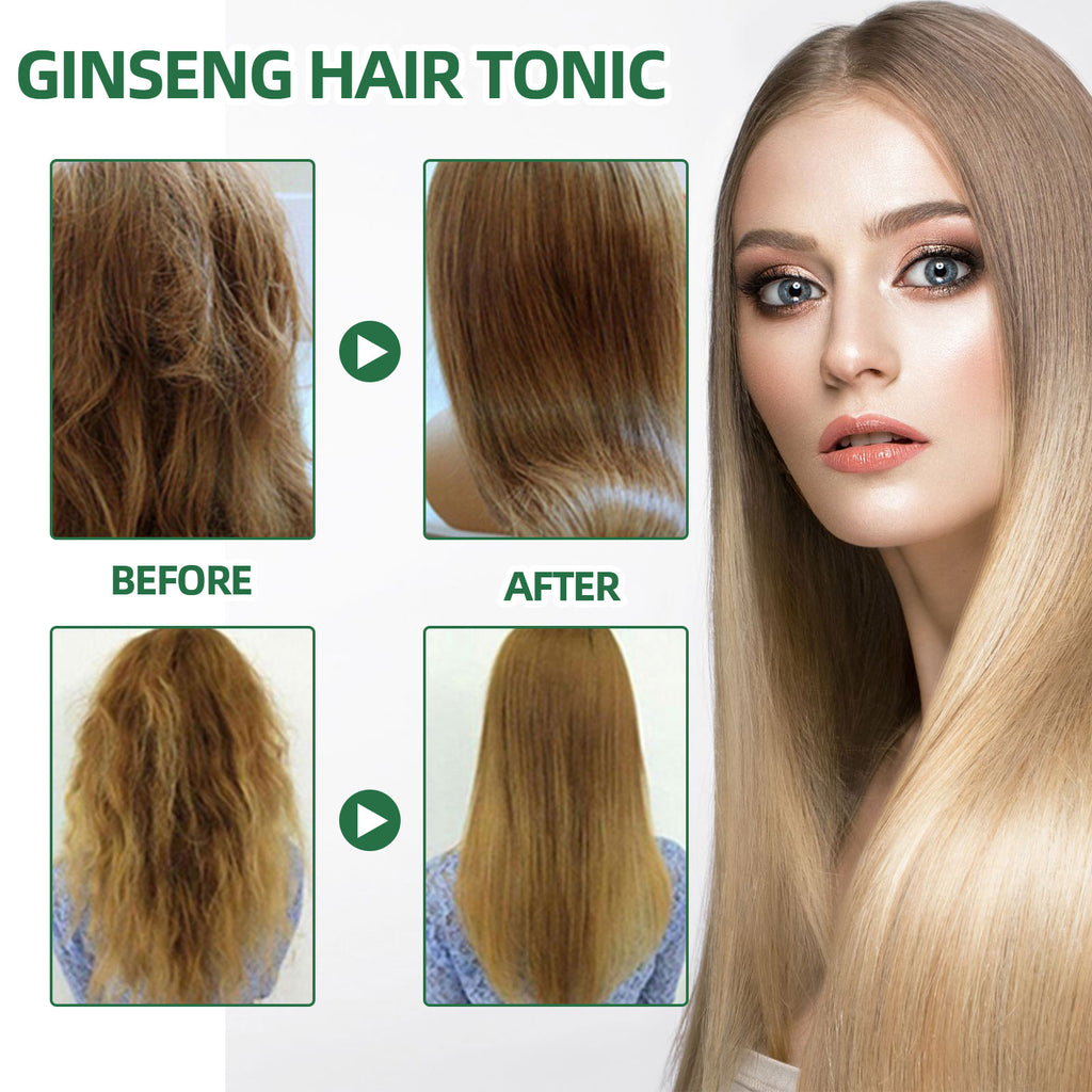 OUHOE Ginseng Hair Growth Lotion for Moisturizing and Hair Regrowth Care